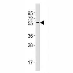 Western blot testing of MITF antibody at 1:2000 dilution + A375 lysate; Predicted molecular weight: 