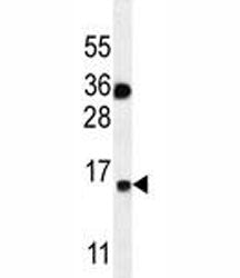 S100A1 Antibody