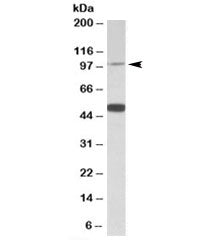 PTCHD1 Antibody