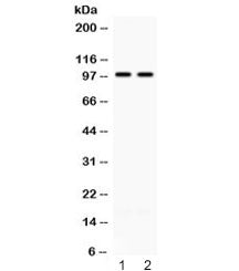 Western blot testing of 1) rat brain and 2) mouse brain lysate with ABR antibody at 0.5ug/ml. Predic