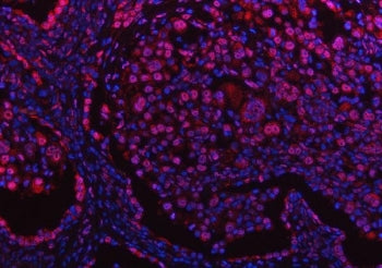 PPM1G Antibody / Protein phosphatase 1G