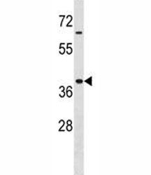Hoxa9 Antibody