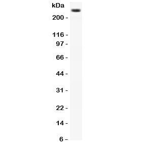 Western blot testing of CACNA1D antibody and rat brain lysate. Expected molecular weight: ~245 kDa.