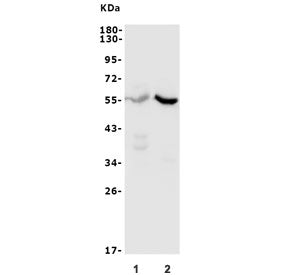 CYP11B1/2 Antibody