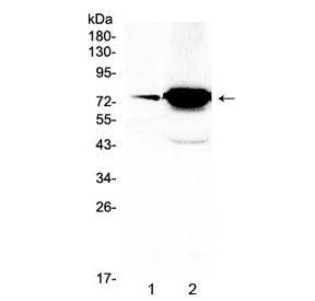 FSH Receptor Antibody
