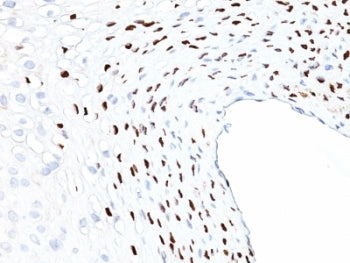 HPV-16 L1 Antibody