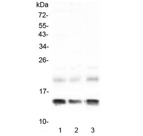 Western blot testing of 1) rat liver, 2) rat RH35 and 3) mouse liver lysate with FABP1 antibody at 0