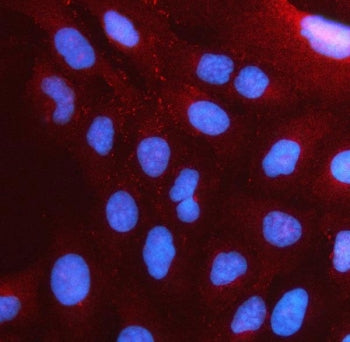 Immunofluorescent staining of FFPE human U-2 OS cells with PSTPIP2 antibody (red) and DAPI nuclear s