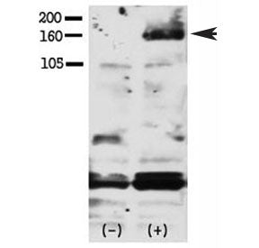 ERBB4 Antibody (phospho-Y1188)