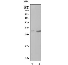 Western blot testing of 1) rat blood and 2) mouse thymus lysate with Cd94 antibody. Expected molecul
