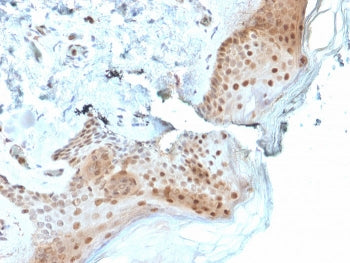 IHC staining of FFPE human skin with OGG1 antibody. HIER: boil tissue sections in pH 9 10mM Tris wit