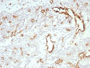 IHC staining of FFPE human uterus tissue with PECAM-1 antibody (clone C31/8828R). HIER: boil tissue 