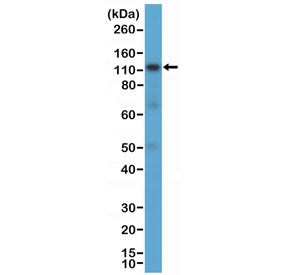 CD30 Antibody