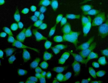 CPN1 Antibody / Carboxypeptidase N catalytic chain