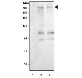 Western blot testing of human 1) SW620, 2) COLO320 and 3) Caco-2 cell lysate with MUC3 antibody. Exp