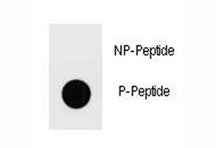 Ammonium transporter Antibody (phospho-T465)