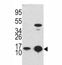 LC3B Antibody (MAP1LC3B)