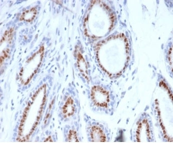PGR Antibody / Progesterone Receptor