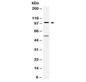Western blot testing of human HepG2 cell lysate with FGFR1 antibody at 0.5ug/ml. Predicted molecular