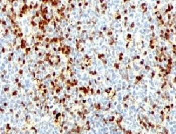 ZAP70 Antibody