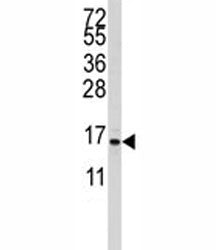 S100A11 Antibody