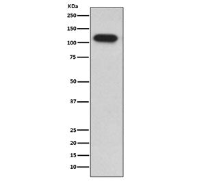 Western blot testing of human HepG2 cell lysate with IDE antibody. Predicted molecular weight ~118 k