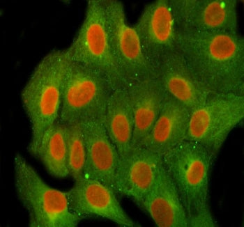 FEN-1 Antibody