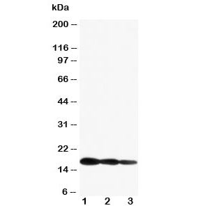 IL1 beta Antibody