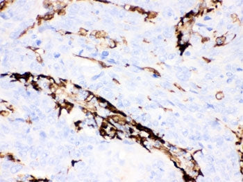 Gelsolin Antibody