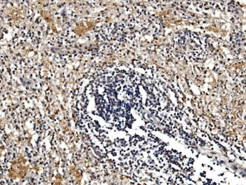 GFPT1 Antibody / GFAT
