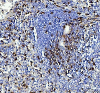 IHC testing of FFPE mouse spleen tissue with CD90 antibody. Required HIER: steam section in pH8 EDTA