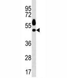 Sgk1 Antibody