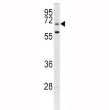 GARP Antibody
