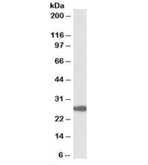 Western blot testing of human cerebellum lysate with PTGDS antibody at 0.3ug/ml. Predicted molecular