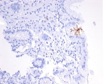 Helicobacter pylori Catalase Antibody