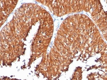 HSP60 Antibody