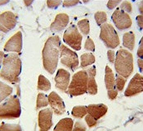 RuvB-like 1 Antibody / RUVBL1 / TIP49A