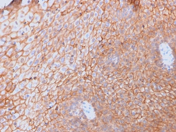 CD40L Antibody / TRAP / CD154