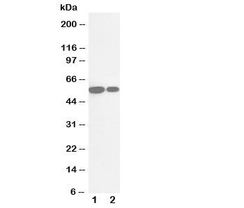 Western blot testing of Cytochrome P450 2E1 antibody and Lane 1: rat liver; 2: mouse liver tissue lysate. Predicted molecular weight ~56kDa.