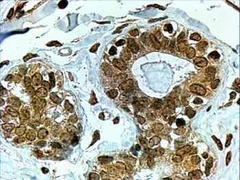 CYP7B1 Antibody