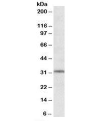 Western blot testing of human hippocampus lysate with GRM2 antibody at 1ug/ml. Predicted molecular w