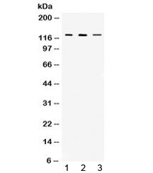 Western blot testing of 1) rat thymus, 2) mouse thymus and 3) MCF7 lysate with CIITA antibody at 0.5