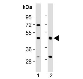 Western blot testing of human 1) brain and 2) lung lysate with HIPPI antibody at 1:2000. Predicted m