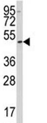 SSB Antibody / Lupus La protein, 0.4ml