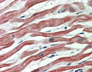 EPM2AIP1 Antibody
