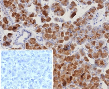RORC Antibody / ROR gamma
