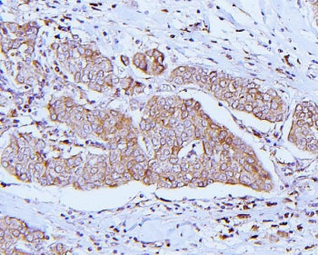 ApoER2 Antibody / LRP8