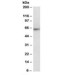 Western blot testing of MOLT4 lysate with SOCS5 antibody at 0.3ug/ml. Predicted molecular weight: ~6