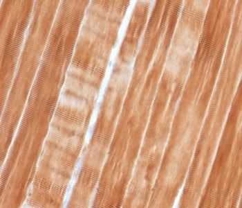 IHC staining of FFPE human skeletal muscle tissue with Sarcomeric Alpha Actinin antibody (clone SAMA