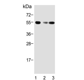 ACVR1B Antibody / Activin receptor type-1B / ALK4